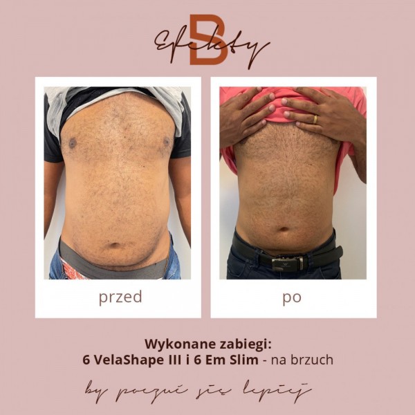 vela-shape-metamorfoza-1a