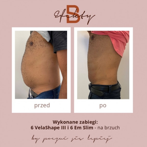 vela-shape-metamorfoza-1c